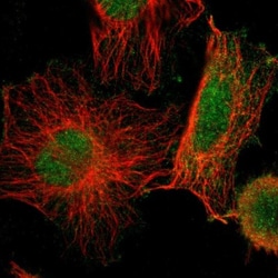 SKT Antibody, Novus Biologicals 25 &mu;L; Unlabeled:Antibodies, Polyclonal